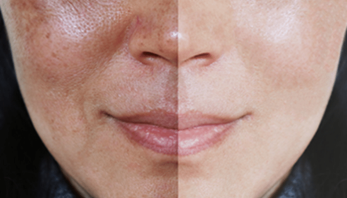 Sun Tanning vs Sun Damage Understanding the Fine Line for Your Skin