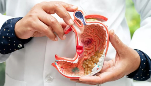 dysphagia treatment in India